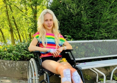 5억 들여 8년 간 키크는 수술…183㎝ 여성모델이 밝힌 심경 