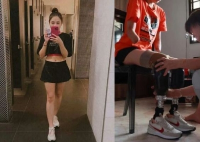 '패혈증으로 사지 절단' 30대女…"직업 찾고 사람들 돕고파"