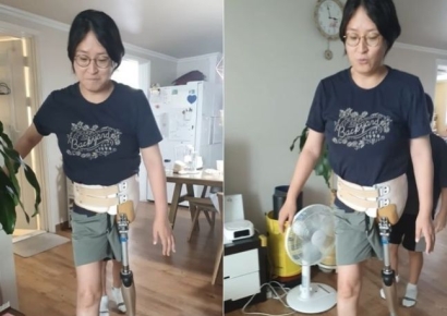 "엄마 조심해"…의족 단 암투병 엄마 첫 걸음에 두 자녀 응원
