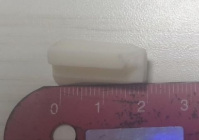 "젤리인줄 알고 '꼭꼭'" 프랜차이즈 아이스크림서 2cm 넘는 '물컹' 이물질 발견