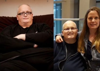 300㎏ 감량하고 인연도 찾아왔지만…'요요'로 다 날린 영국 남성