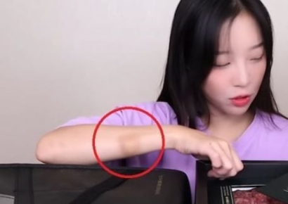 "팔에 멍자국·밴드 폭행 상처였나"…쯔양, 과거 방송장면 재조명