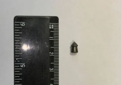 총 맞은 엄마뱃속에 있던 러시아 아기…생존확률 1%뚫었다