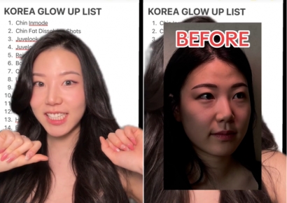 "100만원 넘는 시술, 한국서는 10만원도 안 해"…K뷰티 주목한 美