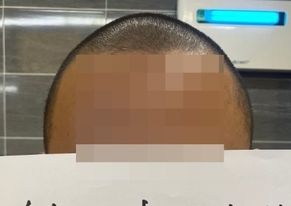 음식에 2㎝ 머리카락 나왔다고?…"제 머리 보세요" 업주 대반격