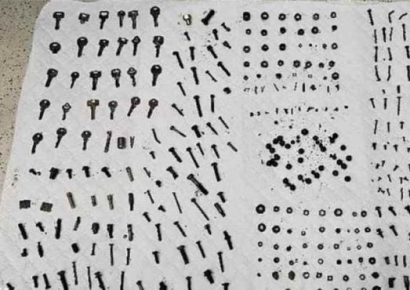 뱃속에 철물점 차렸나…복통에 병원간 남성, 수 백개 볼트·너트 쏟아져