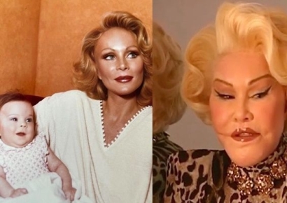 성형 중독돼 수십억 쓴 여성…이혼 후 '위자료 3조'