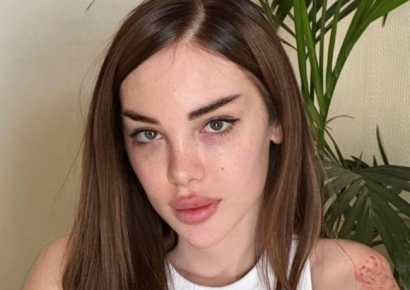 ‘조지아 하리수’ 성소수자 억압하는 법 통과 다음날 피살