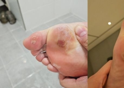 안세영 물집 사진 보여주니…배드민턴협회장 "후원사 규정 바꾸겠다"