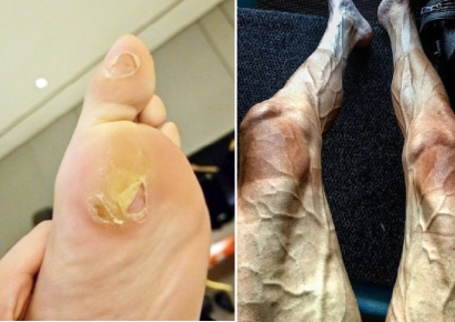 안 맞는 신발 신고 금메달까지…뭉클함 주는 영광의 상처들