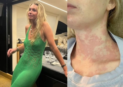 "키스하면 죽는 병"…3시간 금식하고 양치해야 가능하다는 25세 女