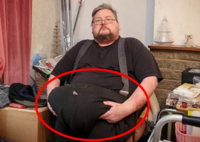 "다이어트로도 뺄 수 없어요"…배에 달린 32㎏ '이 덩어리'의 정체는