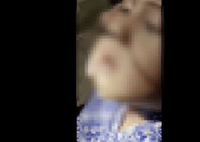 "숨 쉬기 힘들어" 병원 간 10살 소년…콧속에서 빼낸 이것 '경악'