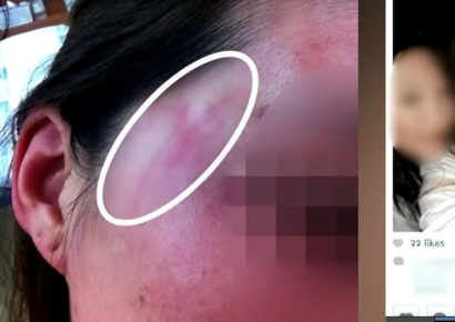 제시 폭행 피해자 또 등장…"가해자가 중국 사람? 웃기고 자빠졌다"