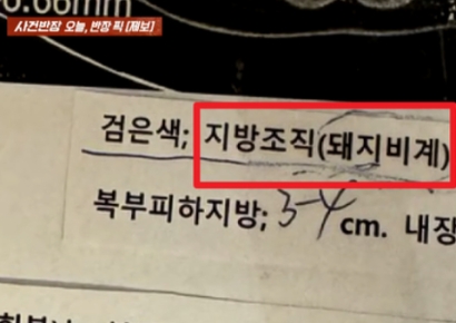 환자 "검사지에 '돼지비계' 너무해"…의사 "좋은 말 원하면 정신과로"