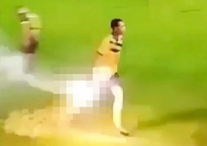 관중이 던진 폭죽 줍다가 '펑'…손가락 절단된 축구 선수