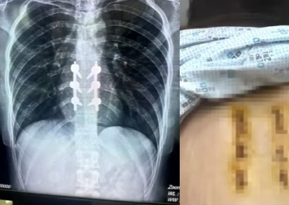 여친 바다에 던져 척추 골절시킨 남성…"그런 적 없다" 발뺌했지만