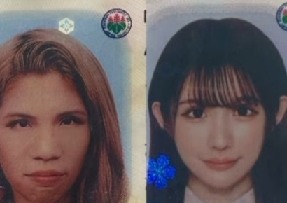 "성형 전 이랬어요"…‘2억 성형’ 日 인플루언서, 과거 사진 대방출