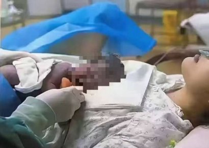 "우리 아이 맞나요?" 출산 후 아이 피부색에 경악한 中 여성