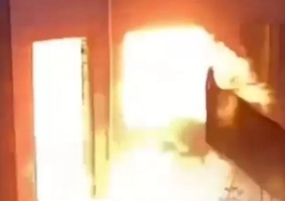 온몸에 화상 입은 남편, 아내 구하러 불속으로 뛰어들었다