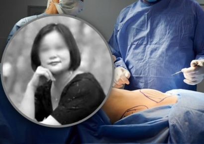 예뻐지려고 눈·코·허벅지 하루 6번 수술받은 中 여성 결국