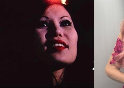 "보톡스 맞은 줄 알았는데…얼굴 세 배 커져" 유명 여배우 충격 근황