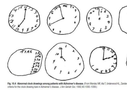 "시계 그려보세요"… 치매 알 수 있는 간단 테스트