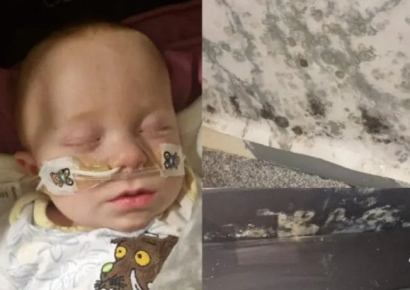 "공공주택이 곰팡이 천지"…생후 6개월 입원에 난리난 英