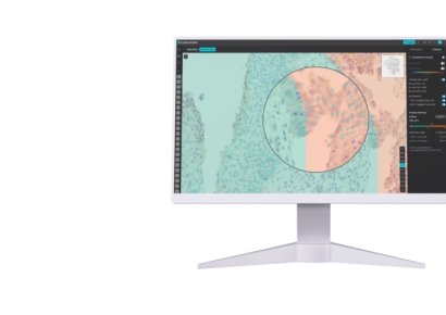 루닛 "AI로 면역조직염색 범용 분석 가능"…네이처 자매지에 게재