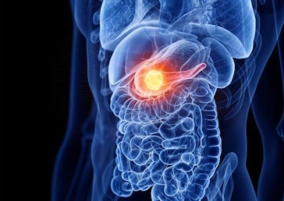 "증상은 하나뿐"…돌연 췌장암 말기 선고받은 전직 마라토너