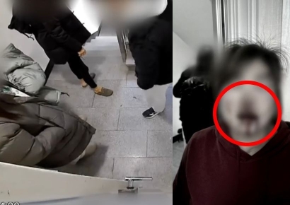 '띵동' 소리에 문 열었다가 주먹질에 코뼈 골절…"강아지 배변 치우라 했다고"