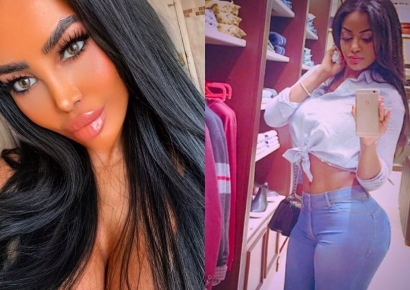 엉덩이 확대 수술 3일 만에…英 플레이보이 모델 사망