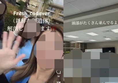 "신선한 해부"…해부용 시신과 기념사진 찍은 의사 결국 해고