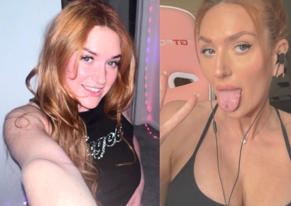 "성적 호기심 대상으로 취급받아"…'이중자궁' 20대 여성 토로