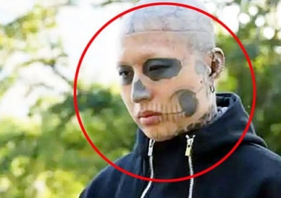 얼굴 전체에 문신 덮은 중국 남성…"평범한 삶 원해" 제거 시작