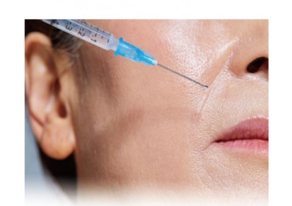 국내 판매만 13곳, 보툴리눔 톡신 시장에 무슨 일이