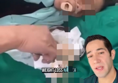 덜 익힌 돼지고기 먹은 여성, 입에서 줄줄 나온 '이것'의 놀라운 정체