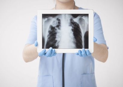 엑스레이 검사 언제든 가능한가?… 꼭 알아야 할 안전 수칙