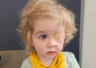 귀엽다며 2살 아기 얼굴에 뽀뽀했다가…왼쪽 눈 '실명'