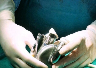 호주 남성, '티타늄 인공심장'으로 105일간 생존