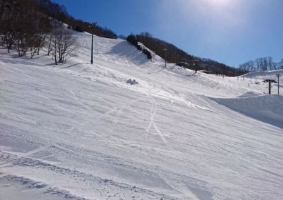 10분이면 질식하는데…7시간 버틴 노르웨이 '눈사태' 생존자 비결