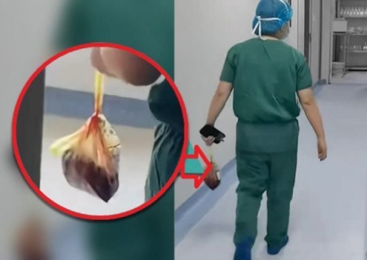 암암리에 고액에 판매…中 산부인과 의사가 몰래 빼돌린 비닐봉지의 정체
