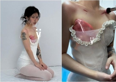 보석으로 만든 인공 가슴…"제 2의 심장 얻어"