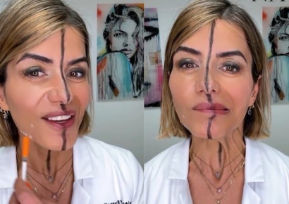 한쪽 얼굴에만 보톡스, 자기 얼굴에 실험한 의사가 내린 결론