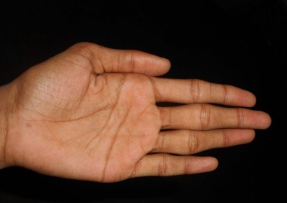 목욕 후 '퉁퉁' 불며 생기는 손가락 주름…"매번 같은 형태였다"