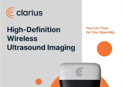 스피어, 캐나다 AI의료 무선 초음파 스캔 시스템 국내 독점 공급