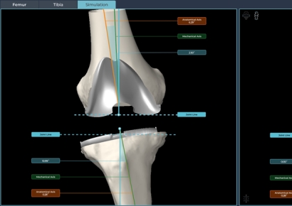 스카이브, AI 수술 설계부터 협업·시뮬레이션까지…통합 플랫폼 공개 