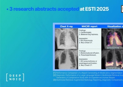 딥노이드 "M4CXR 관련 연구, ESTI 2025서 초록 채택"