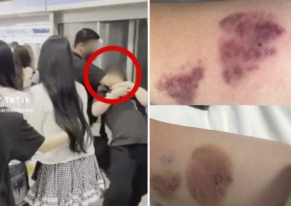 "짐승 다루듯 제압 당해, 전치 4주"…'과잉 경호' 피해자 사진 공개