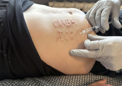 포로였던 우크라 군인 복부에 새겨진 글귀 보고 경악한 의사